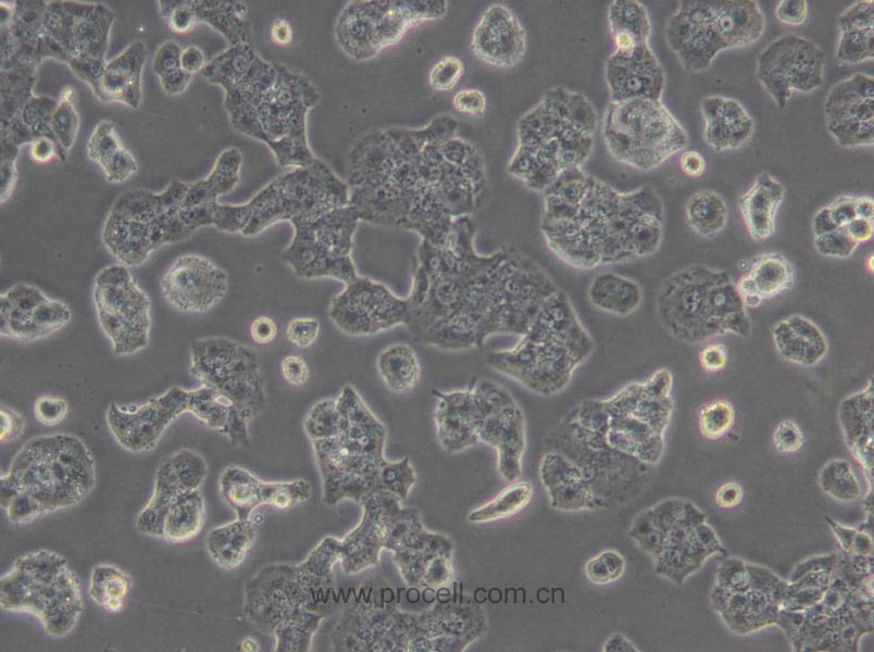 Beta-TC-6 (小鼠胰岛素瘤胰岛β细胞) (种属鉴定正确)
