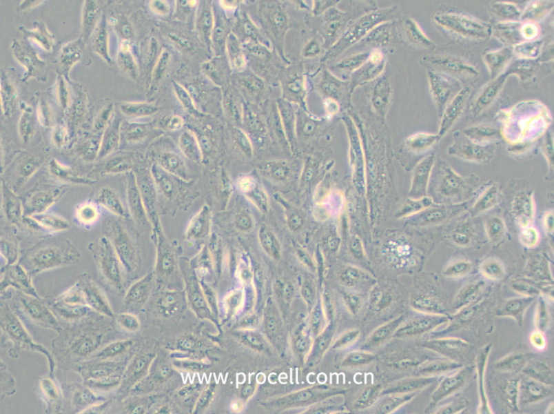 Caki-2 (人乳头状肾细胞癌细胞)(STR鉴定正确)