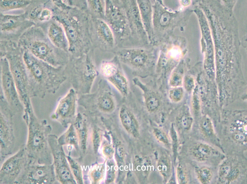 Caki-2 (人乳头状肾细胞癌细胞)(STR鉴定正确)