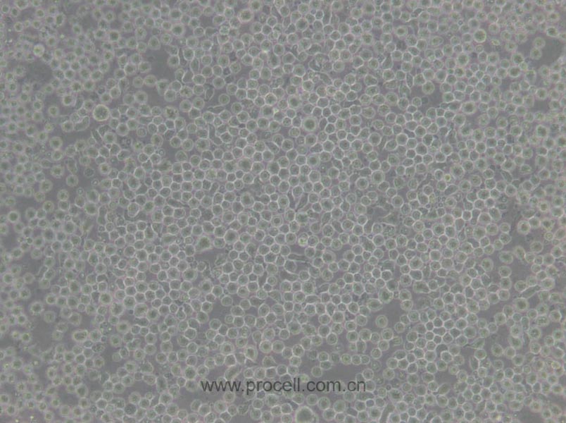 CEM/C1 (人急性淋巴细胞白血病细胞) (STR鉴定正确)