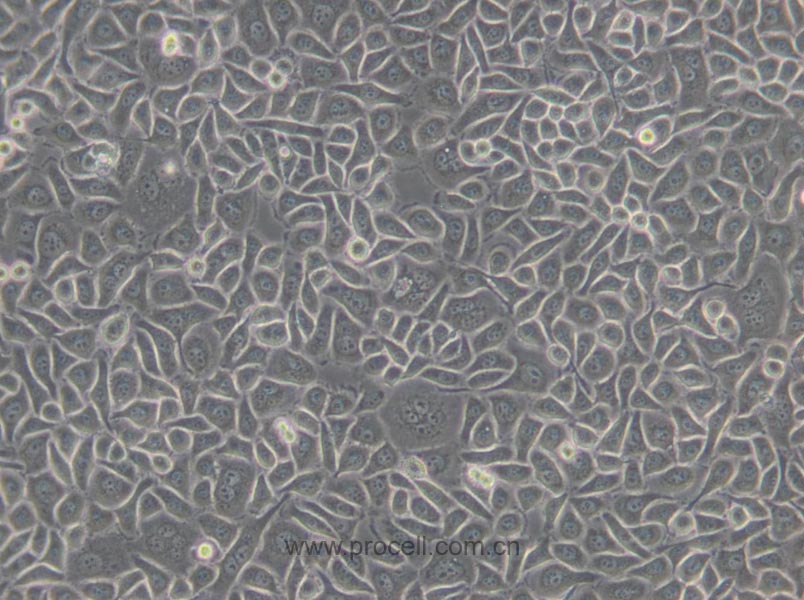 Chang liver (人张氏肝细胞) (Hela污染细胞系，暂不供应)