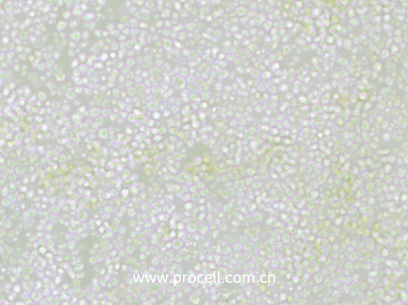 OKT 11 (小鼠杂交瘤细胞(抗CD2))(种属鉴定正确)