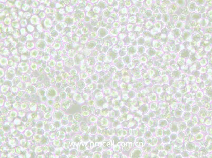 OKT 11 (小鼠杂交瘤细胞(抗CD2))(种属鉴定正确)