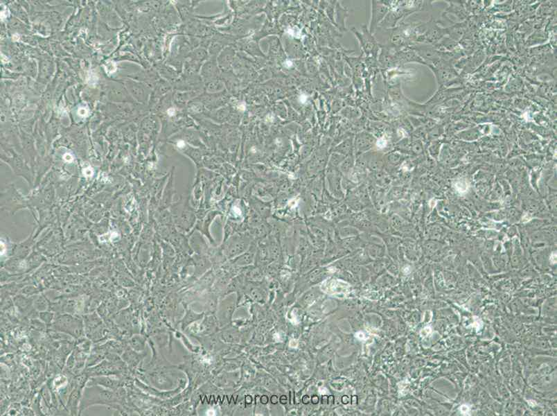 HCC38 (人乳腺导管癌细胞) (STR鉴定正确)