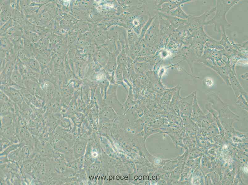 HCC38 (人乳腺导管癌细胞) (STR鉴定正确)