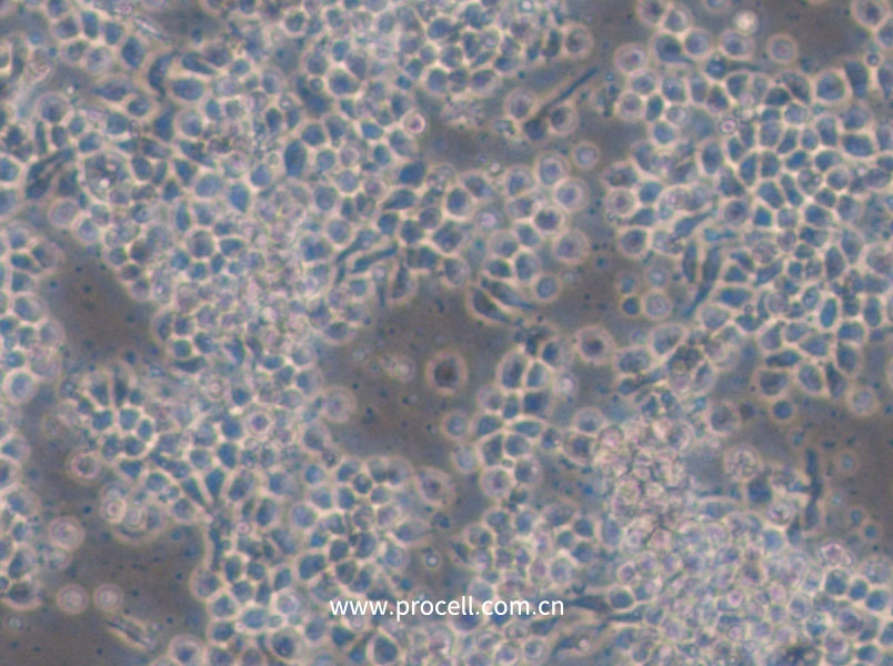 Hce-8693 (人盲肠腺癌细胞(未分化)) (STR鉴定正确)