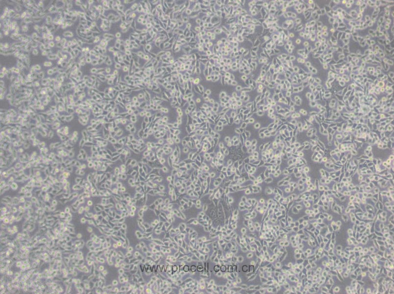 L Wnt-3A (小鼠皮下结缔组织细胞) (STR鉴定正确)