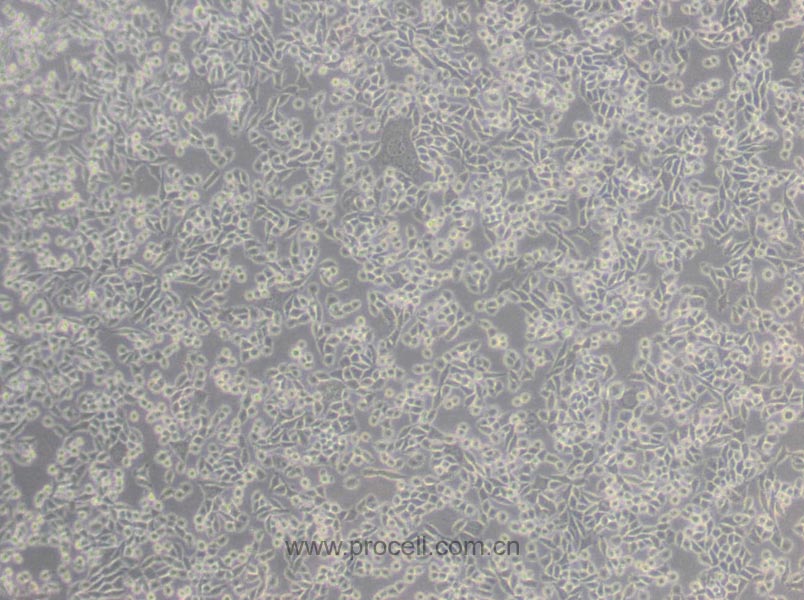L Wnt-3A (小鼠皮下结缔组织细胞) (种属鉴定正确)
