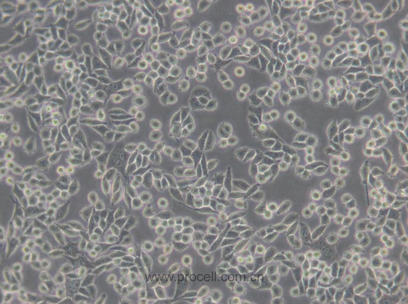 L Wnt-3A (小鼠皮下结缔组织细胞) (种属鉴定正确)