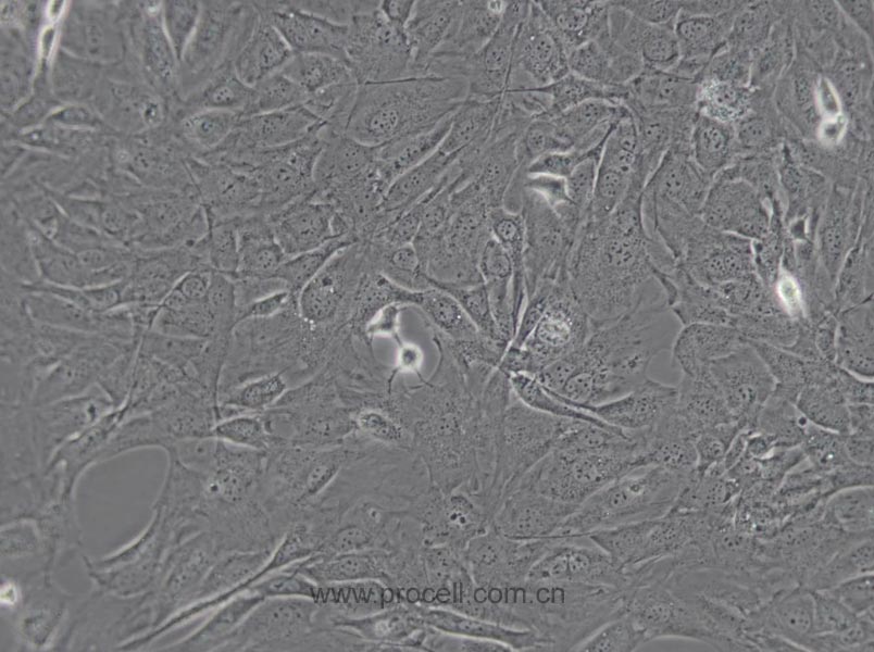 MC3T3-E1 Subclone 14 (小鼠颅顶前骨细胞亚克隆14) (STR鉴定正确)