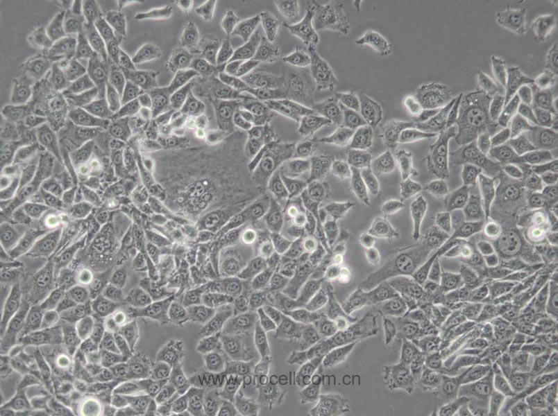 MDA-MB-415 (人乳腺癌细胞) (L15) (STR鉴定正确)