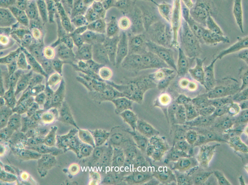 NCI-H157 (人非小细胞肺腺癌细胞) (STR鉴定正确)