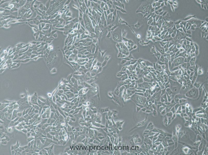 NCI-H358 (人非小细胞肺癌细胞) (STR鉴定正确)