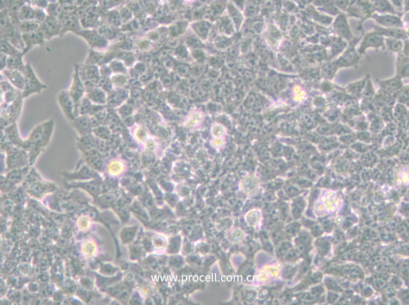 NCI-H520 (人肺鳞癌细胞) (STR鉴定正确)