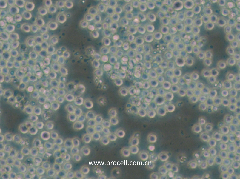 P3/NSI/1-Ag4-1 [NS-1] (小鼠骨髓瘤细胞) (种属鉴定正确)