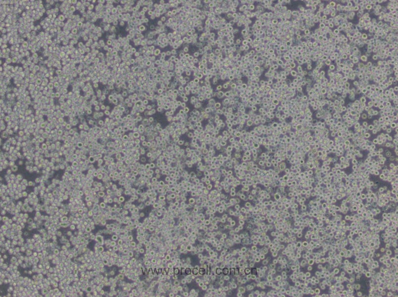 P3X63Ag8.653 (小鼠骨髓瘤细胞) (STR鉴定正确)