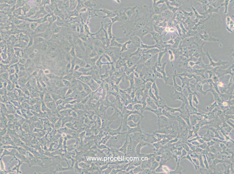 PA-1 (人卵巢畸胎瘤细胞)(STR鉴定正确)