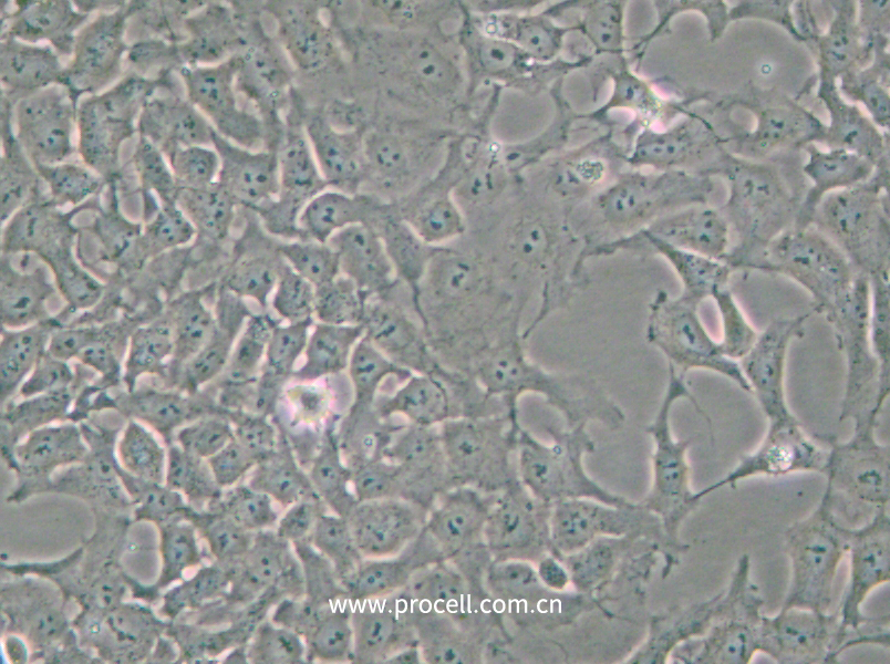 PA-1 (人卵巢畸胎瘤细胞)(STR鉴定正确)