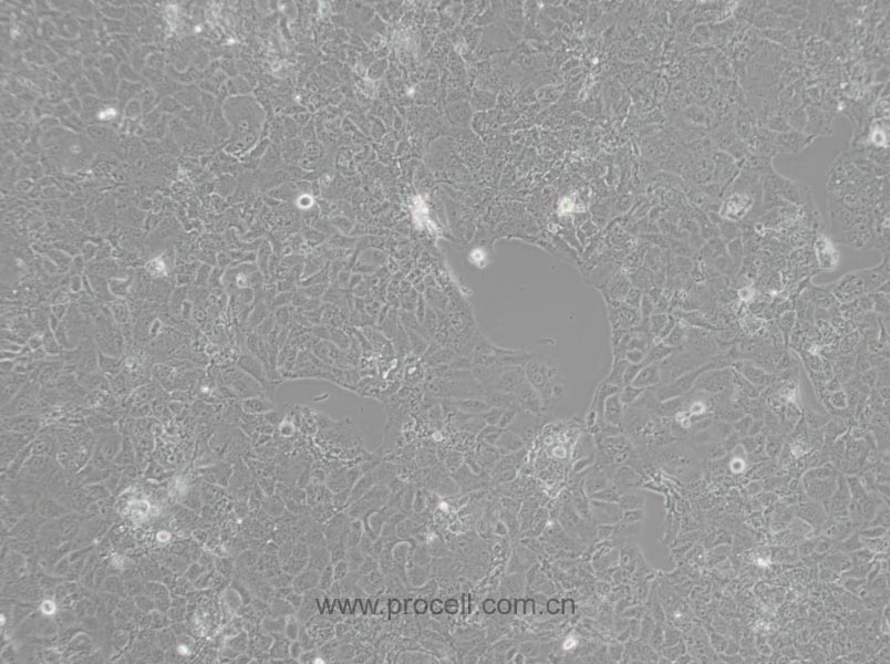 PLC/PRF/5 (人肝癌亚力山大细胞) (STR鉴定正确)