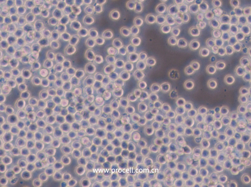 Sp2/0-Ag14[SP2/0] (小鼠骨髓瘤细胞) (STR鉴定正确)