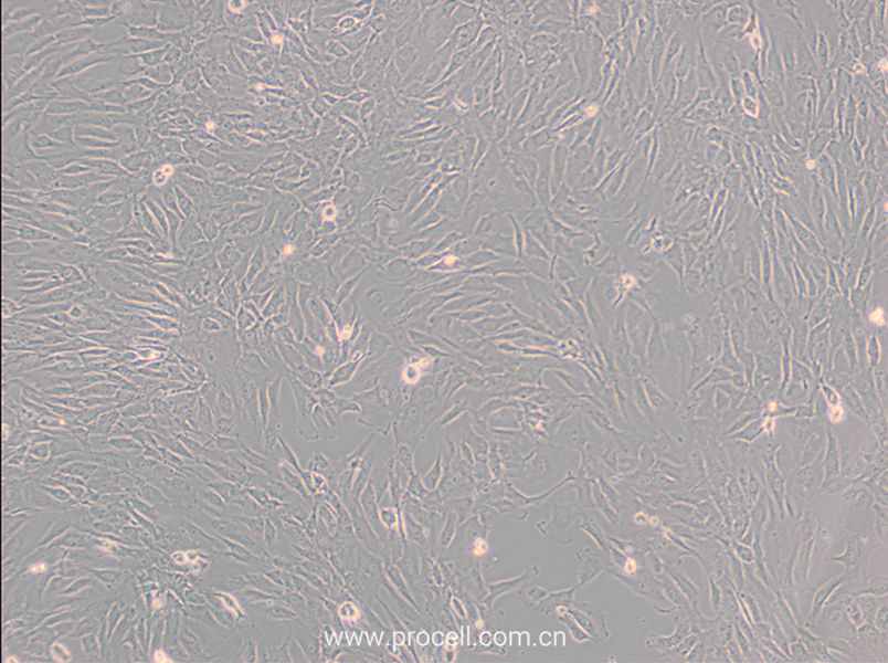 SW 982 [SW-982, SW982] (人滑膜肉瘤细胞)（DMEM） (STR鉴定正确)
