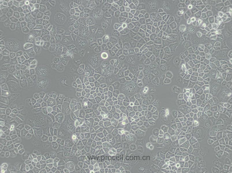 SW-13 (人肾上腺皮质小细胞癌细胞) （L15）(STR鉴定正确)