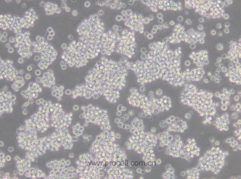L5178Y TK+/- clone(3.7.2C) (小鼠淋巴瘤细胞) (STR鉴定正确)