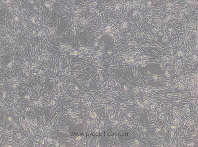 TM4 (正常小鼠睾丸Sertoli细胞) (STR鉴定正确)