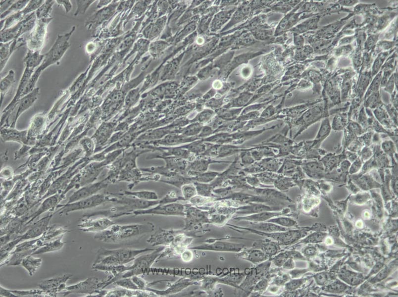 U-118 MG (人脑星形胶质母细胞瘤) (STR鉴定正确)
