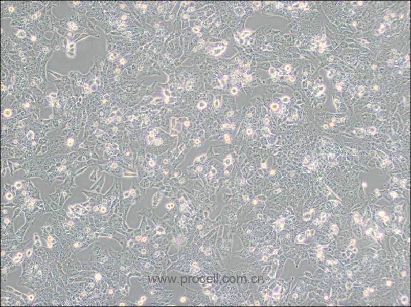 UMR-106 (大鼠骨肉瘤细胞) (种属鉴定正确)