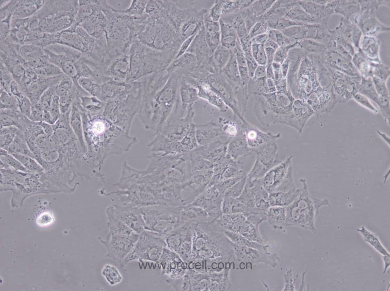 UMR-106 (大鼠骨肉瘤细胞) (种属鉴定正确)