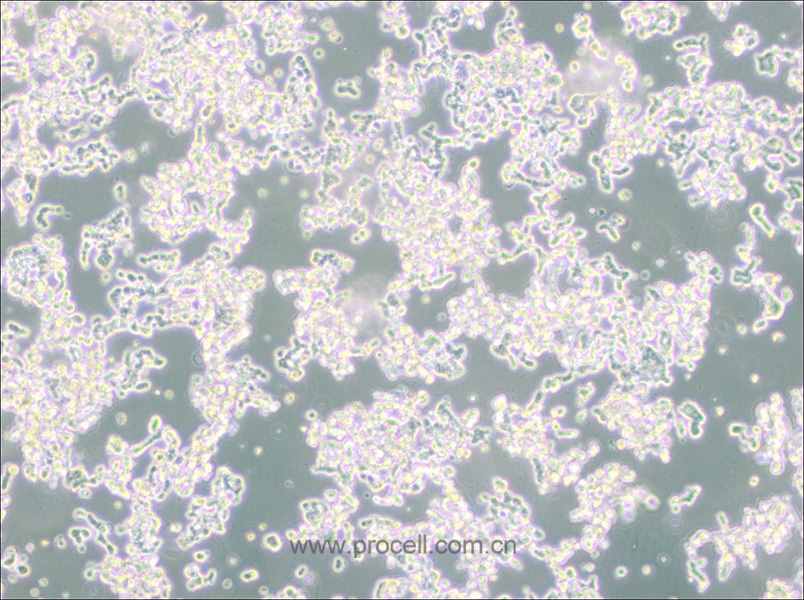 WERI-Rb-1 (人视网膜神经胶质瘤细胞) (STR鉴定正确)