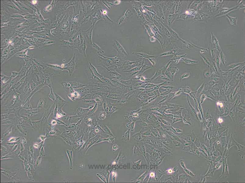 WPMY-1 (人正常前列腺基质永生化细胞) (STR鉴定正确)
