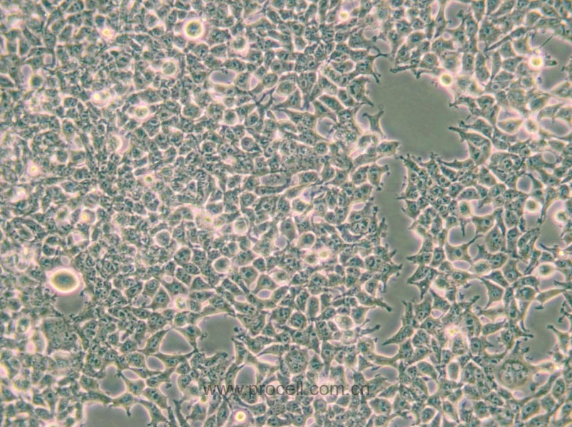 293T/17 (人胚肾细胞) (STR鉴定正确)
