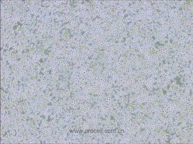 AE-2 (小鼠杂交瘤细胞(抗AChE))(种属鉴定正确)