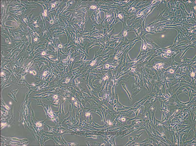 BALB/3T3 clone A31 (小鼠胚胎成纤维细胞) (种属鉴定正确)