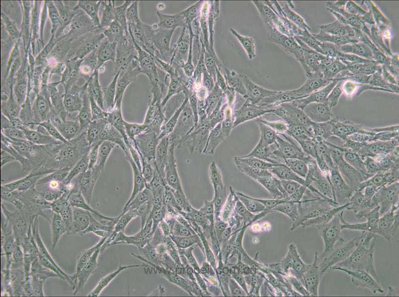 BALB/3T3 clone A31 (小鼠胚胎成纤维细胞) (种属鉴定正确)
