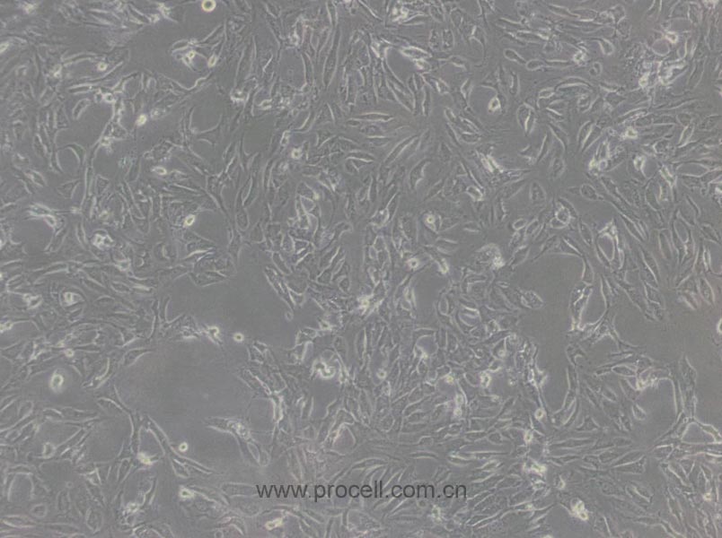 BALB/3T3 clone A31 (小鼠胚胎成纤维细胞) (STR鉴定正确)