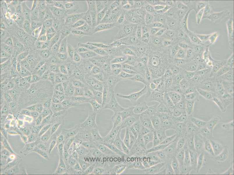 MA-104 [MA 104; MA104] (非洲绿猴胚胎肾细胞)(种属鉴定正确)