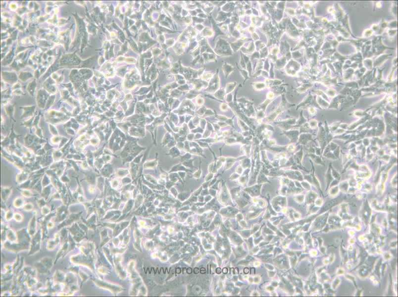 PC-12 (低分化) (大鼠肾上腺嗜铬细胞瘤细胞(低分化)) (种属鉴定正确)