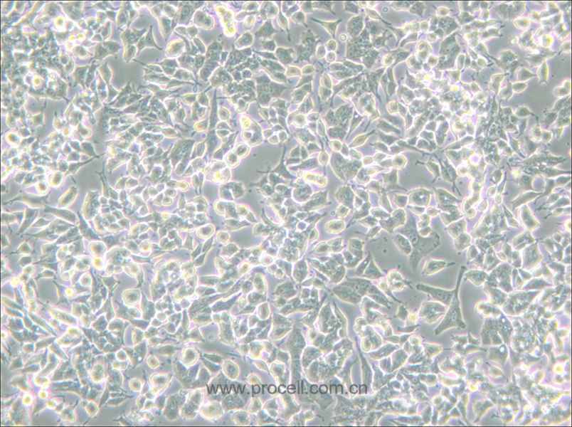PC-12 (低分化) (大鼠肾上腺嗜铬细胞瘤细胞(低分化)) (种属鉴定正确)