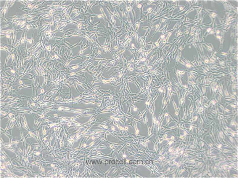 PC-12 (高分化) (大鼠肾上腺嗜铬细胞瘤细胞(高分化)) (种属鉴定正确)