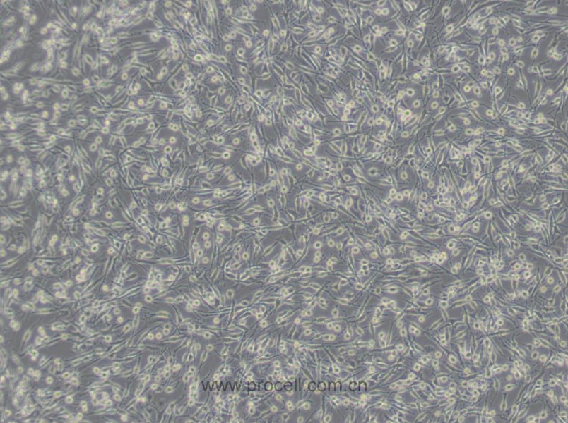 PC-12 (高分化) (大鼠肾上腺嗜铬细胞瘤细胞(高分化)) (种属鉴定正确)