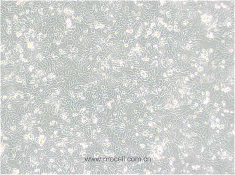 CHO/dhFr- [CHO-DXB11] (仓鼠卵巢细胞(二氢叶酸还原酶缺陷))(种属鉴定正确)