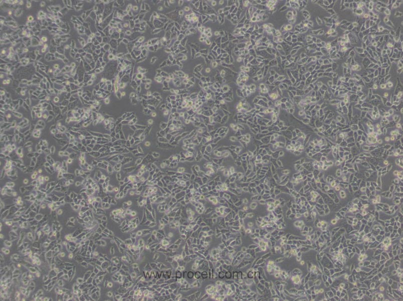 CHO/dhFr- [CHO-DXB11] (仓鼠卵巢细胞(二氢叶酸还原酶缺陷))(种属鉴定正确)