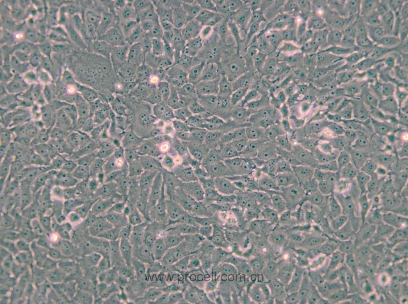 Mv.1.Lu [NBL-7; Mv1Lu] (貂肺上皮细胞)