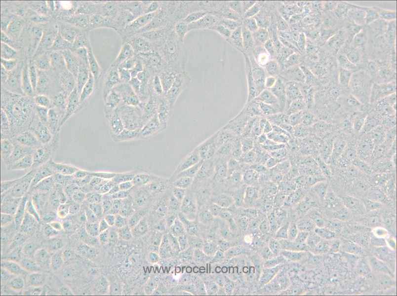 VERO C1008 [Vero E6] (非洲绿猴肾细胞) (种属鉴定正确)