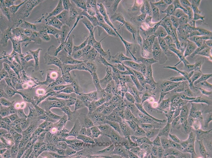 MNNG/HOS Cl #5 [R-1059-D] (人骨肉瘤细胞) (STR鉴定正确)