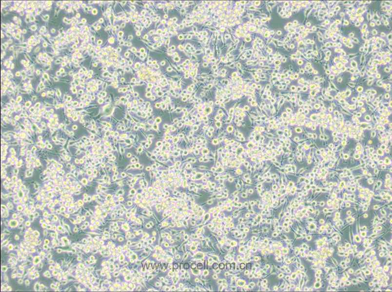 BV2 (小鼠小胶质细胞) (种属鉴定正确)