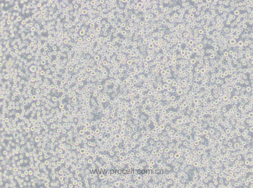 U266 (人多发性骨髓瘤细胞) (STR鉴定正确)